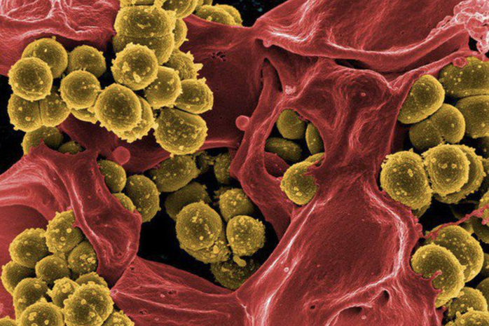 Thiếu niên nguy kịch vì heo cắn - Ảnh 2.