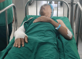 Sơ cứu đúng, đừng chậm trễ - Ảnh 1.