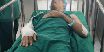 Sơ cứu đúng, đừng chậm trễ - Ảnh 1.